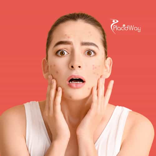 Skin Cancer Treatment Explained for Patients Considering Care in Mexico